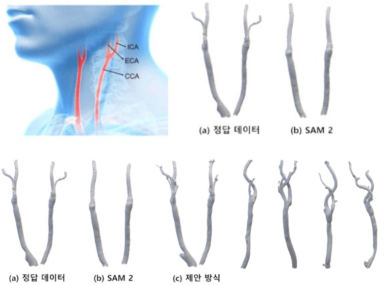 3D Vessel Structure Reconstruction
